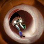 Cutting-Edge Endoscopy Device Receives FDA Breakthrough Device Designation, Paving Way for Improved GI Tract Diagnosis and Treatment
