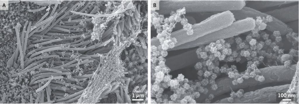 Image of COVID-19 virus (ball-like structures) on the ends of cilia in the respiratory tract