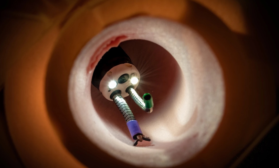 Cutting-Edge Endoscopy Device Receives FDA Breakthrough Device ...